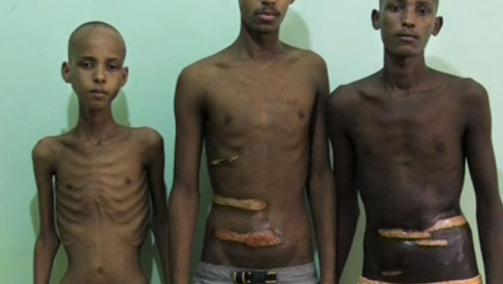 Organ harvest: IOM warns Nigerians against foreign travel agencies