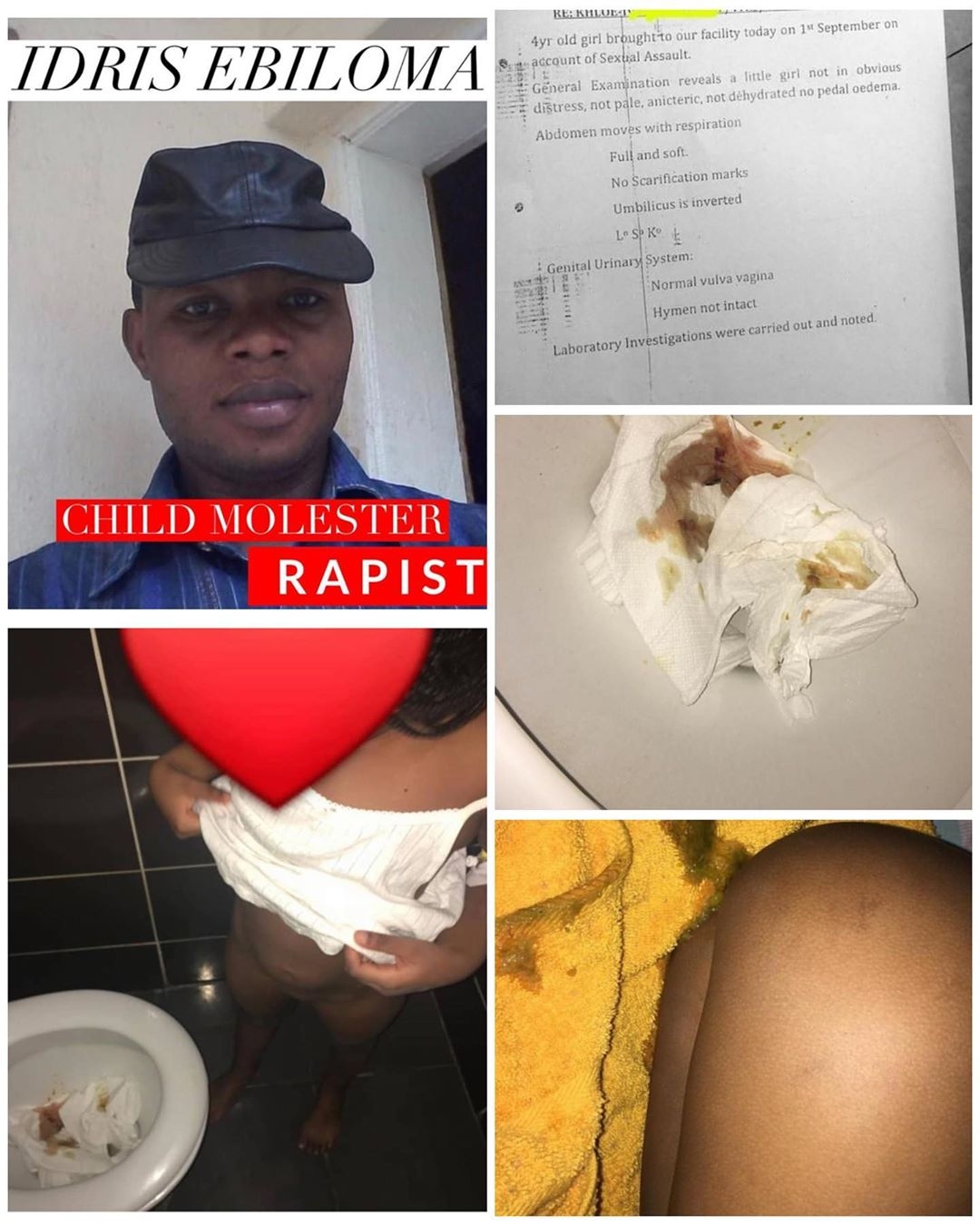RMD writes police over rape of 4-year-old in Abuja RMD writes police over rape of 4-year-old in Abuja