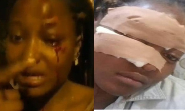 Policemen brutalize FUTA student who refused them sex