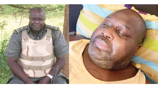 Nigerian hospital treats police officer for ‘brain tumour’ that was never there