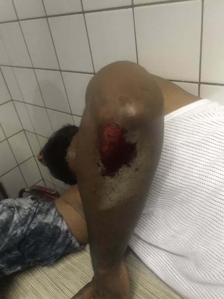 Sowore: Miscreants attack protesting activists in Abuja