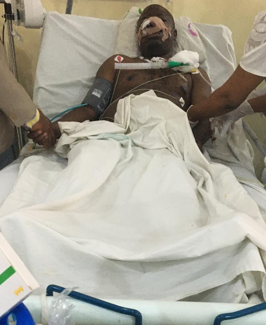 Woman attacks husband, cuts off his nose, upper teeth in Owerri