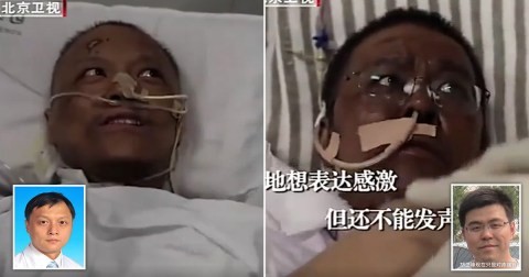 Chinese doctors infected with coronavirus wake to changed skin colour