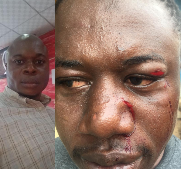 Couple pay assassins to kill neighbour over COVID-19 palliatives  