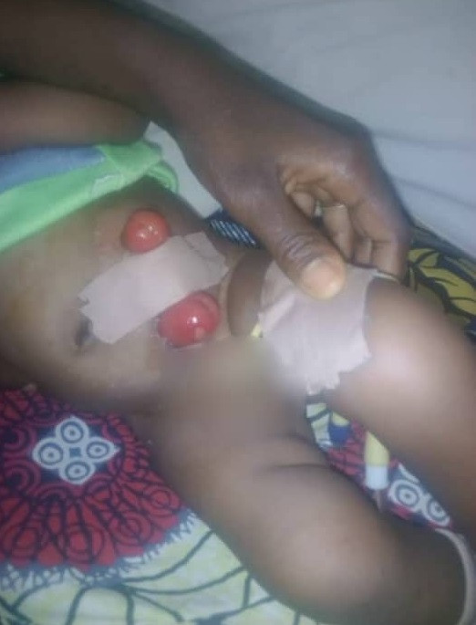 3-month-old baby hospitalized after being raped by unknown person in Nasarawa
