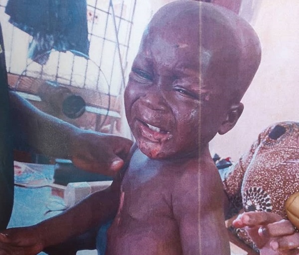 Man arrested for torturing 18-month-old son with lit cigarette