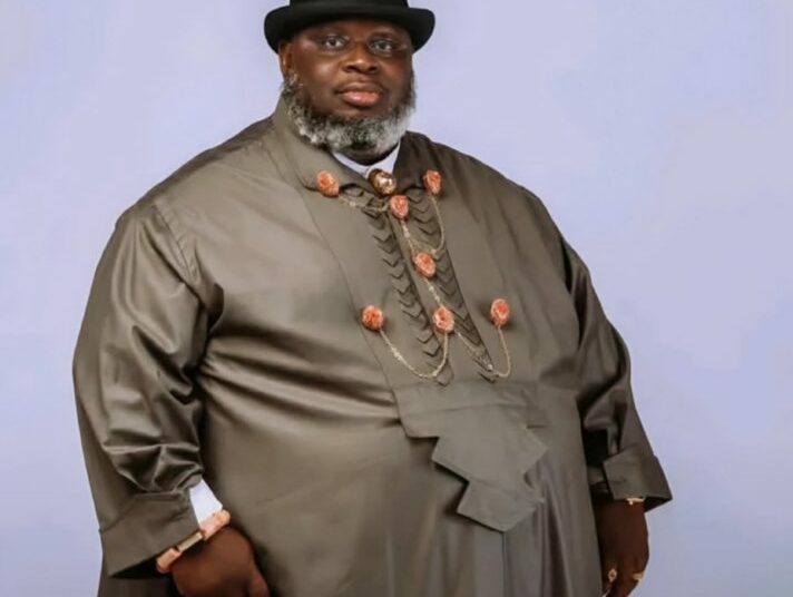 Theophilus Moses, Bayelsa traditional ruler dies after complications from cosmetic surgery Theophilus Moses, Bayelsa traditional ruler dies after complications from cosmetic surgery